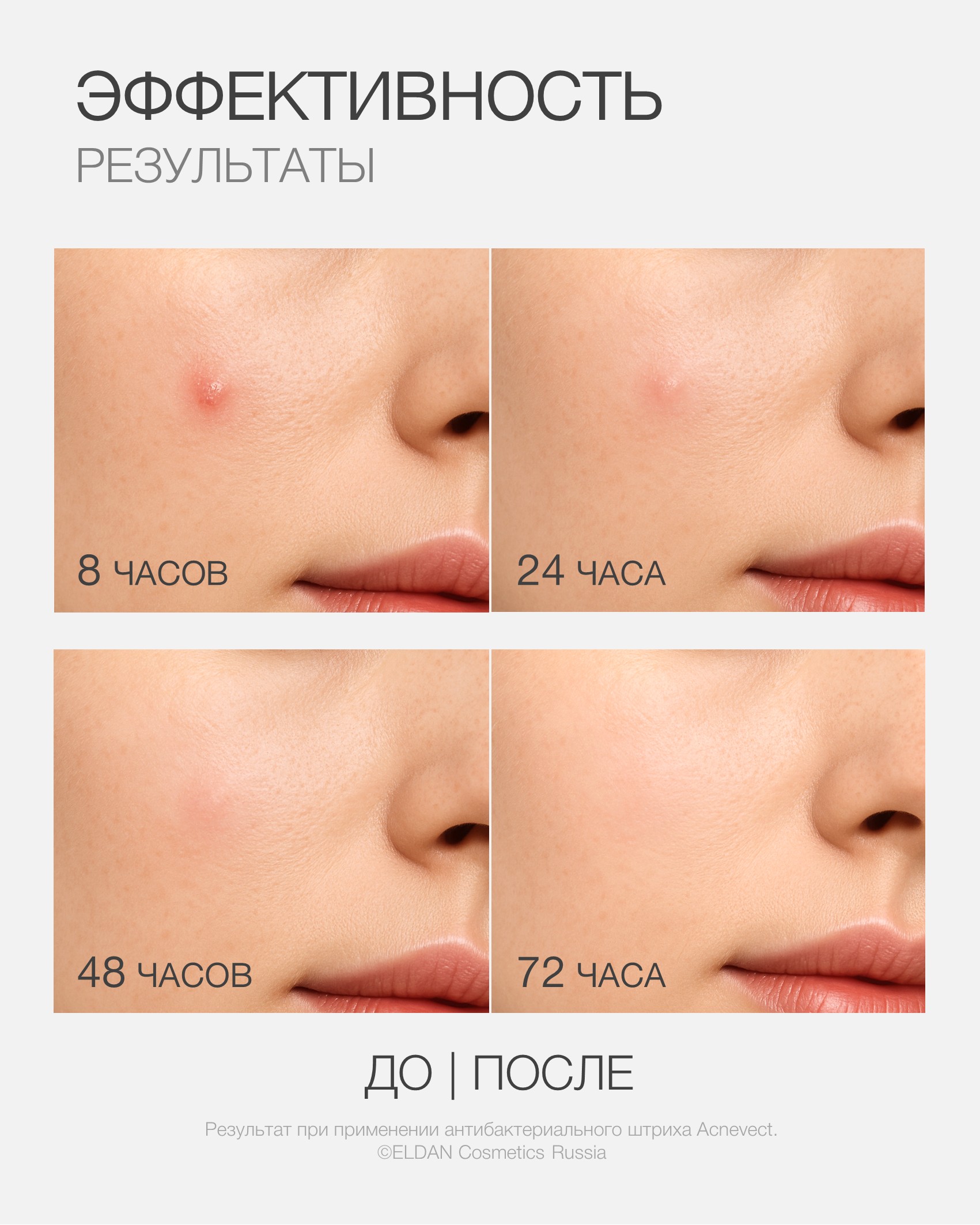 Пост сос акне 4 25.jpg